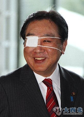 日本首相野田佳彦当地时间16日出现在记者们面前，眼部包着纱布，成了“独眼龙”
