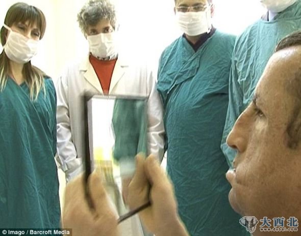 19岁的阿卡感谢医生成功修复他的面部。在还是一个婴儿的时候,他就因为房子失火毁容 19岁的阿卡感谢医生成功修复他的面部。在还是一个婴儿的时候,他就因为房子失火毁容