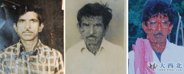 前后变化：左侧是乌马尔在1987年37岁时拍的照片；中间是1998年他48岁时拍的照片；右侧是2006年56岁时拍的照片