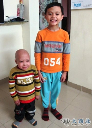 越南15岁少年杜文勇（左）和他10岁的弟弟。