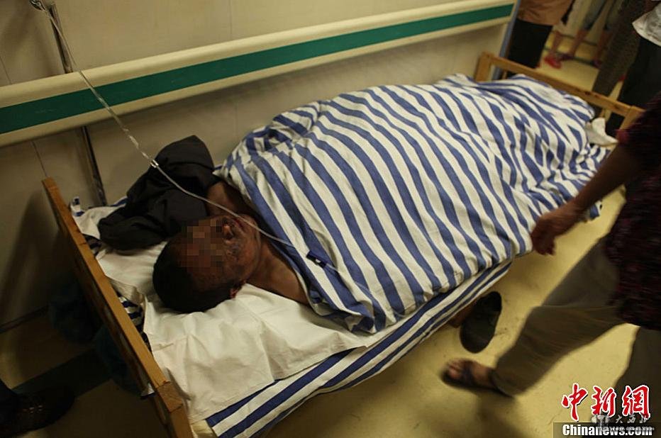 5月11日14时15分许,四川省泸州市泸县桃子沟煤矿发生一起瓦斯爆炸事故,共有81人获救(其中重伤5人、轻伤11人),27人遇难。