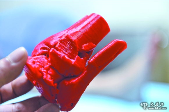 新疆首例3D术前模拟骨折整复手术成功 新疆首例3D术前模拟骨折整复手术成功